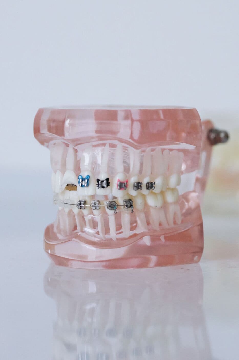 Braces