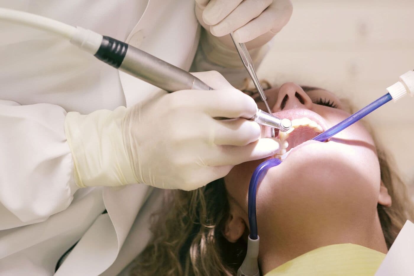 Root canal treatment (RCT)