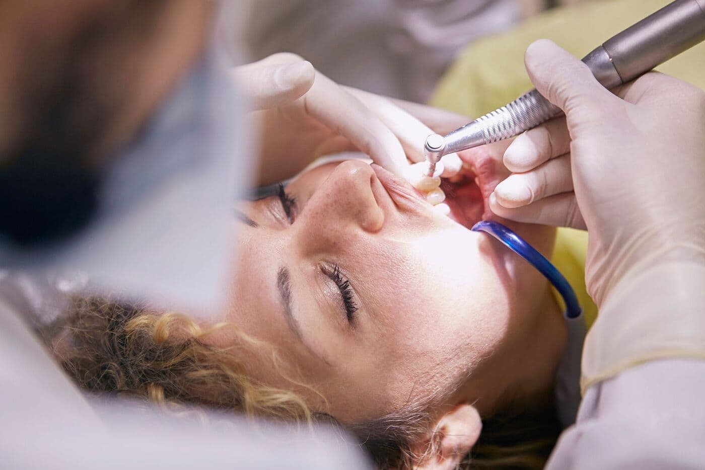 Teeth cleaning & air polishing